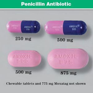 Amoxicillin for swollen lymph nodes